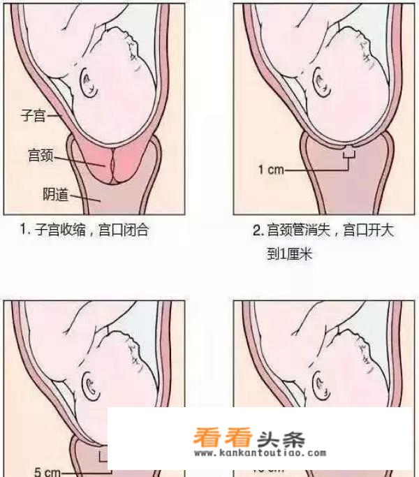 顺产宫口开十指，究竟是什么感觉？