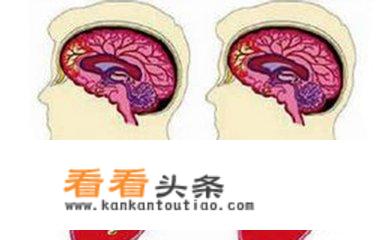 脑梗死患者需要注意哪些问题？