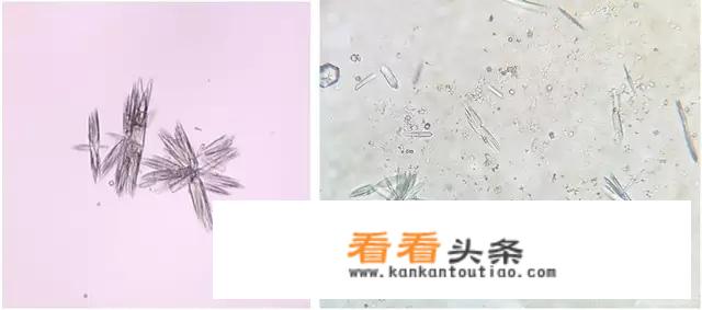 痛风怎样控制？