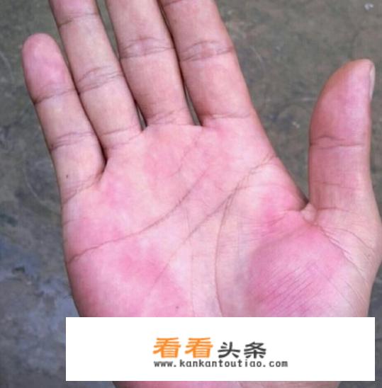 玉镯戴手上颜色变的不透了证明身体哪里不健康？