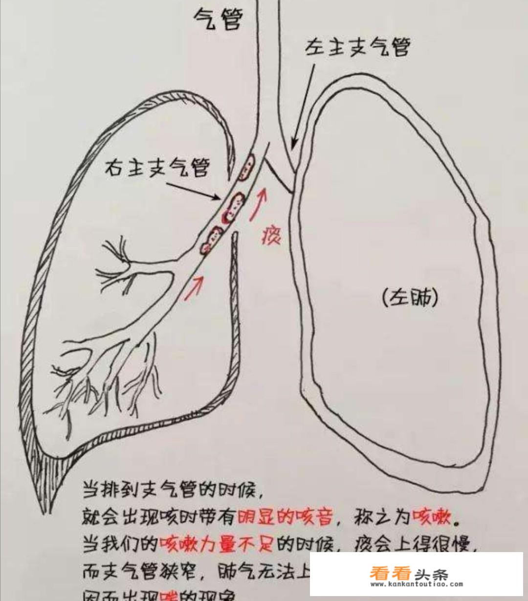 黄痰和白痰哪个厉害，黄痰和白痰的不同之处？