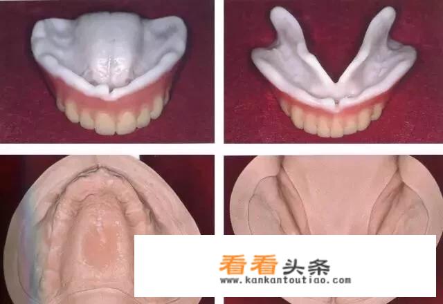 我的牙活动了。怎么才能把牙弄掉，不疼？