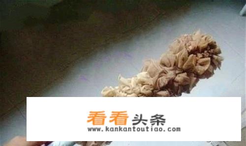 男人异装癖，穿女式超薄丝袜，情趣内衣，现代医学界还认为是病吗？