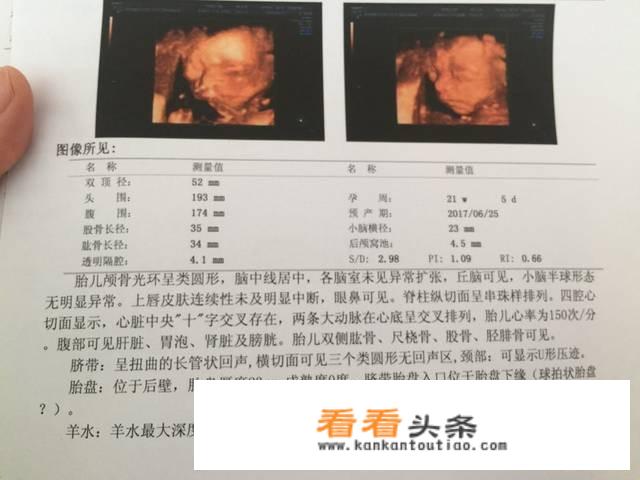 大排畸做四维还是三维好？
