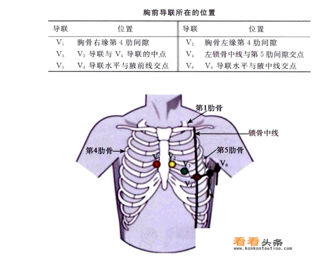 做心电图时导联位置如何安放？