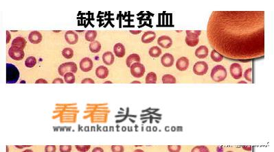 贫血吃什么药补血快？