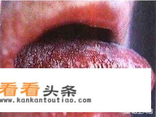 如果一个得了艾滋病的人，去一个绝对安全没有任何细菌的环境，他会得病死亡吗？