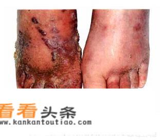 如果一个得了艾滋病的人，去一个绝对安全没有任何细菌的环境，他会得病死亡吗？