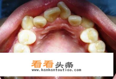入池小说小孩能看吗？