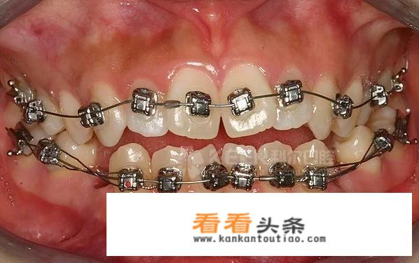 入池小说小孩能看吗？