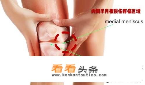 老伴膝关节内侧痛得厉害，坐着痛起床痛下蹲时痛，走路慢点不痛，是什么原因？