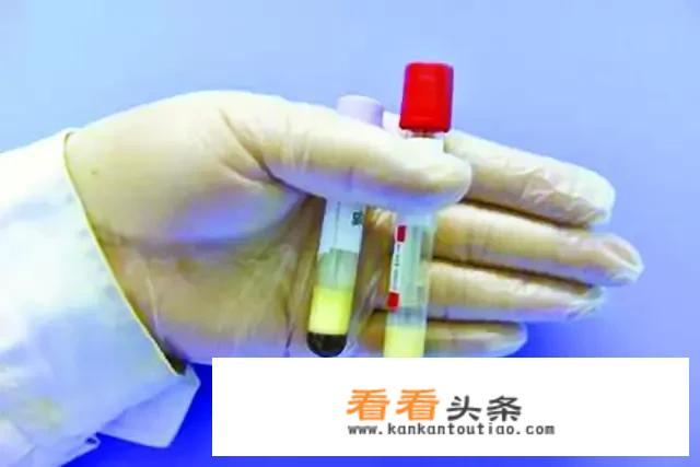 甘油三酯高7点多怎么降吃什么药，吃上注意什么？