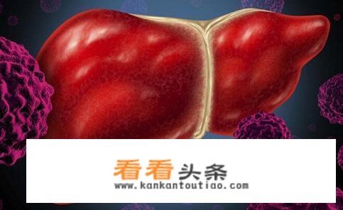 有肝病的朋友在饮食方面要特别注意一些什么事情？