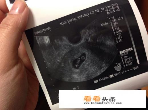 多长时间能知道怀孕