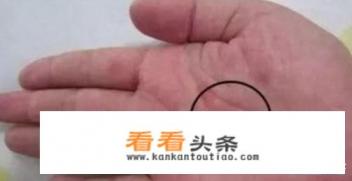 胃不好的人，手上会出现“三处变色，两处异常”，指的是什么