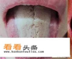 脾虚脾湿吃什么见效快