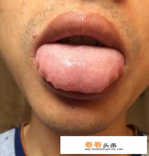 脾虚脾湿吃什么见效快