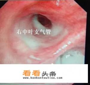 各位妈妈有什么妙招?5岁孩子早上总是赖床