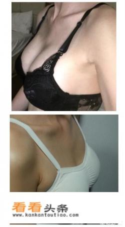 做胸部手术选韩国哪家整形医院好 做胸部手术选韩国哪家整形医院好