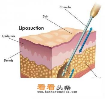 快速减肥的 *** 有哪些 快速减肥的 *** 有哪些